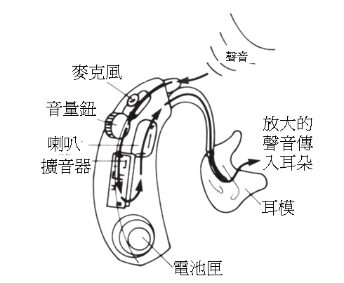 什麼是助聽器？聽損兒是如何透過它來聽聲音？